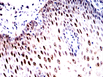 HDAC4 Antibody