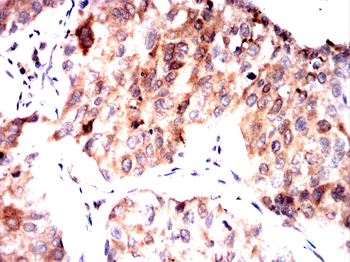 HDAC4 Antibody