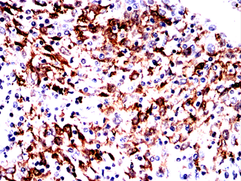 HDAC4 Antibody