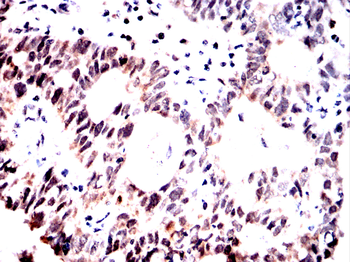 ALYREF Antibody