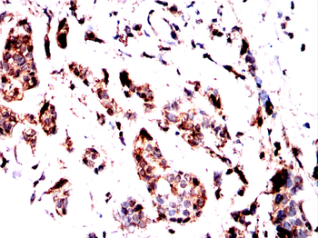 EFEMP1 Antibody