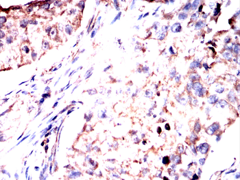 EFEMP1 Antibody