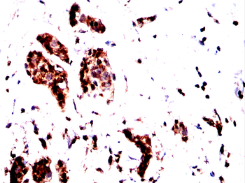 PRMT7 Antibody