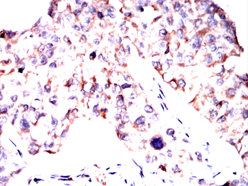 PRMT7 Antibody