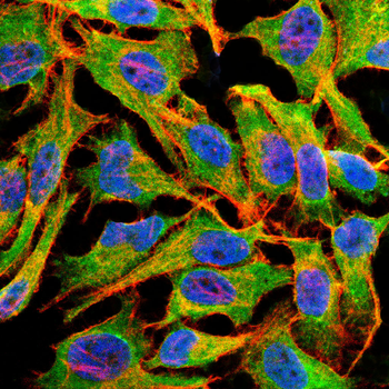 PRMT7 Antibody