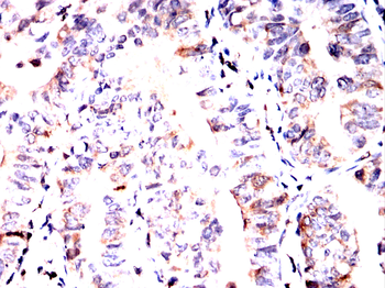 PRMT7 Antibody