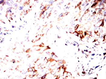 PRMT7 Antibody