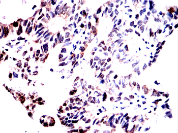 PRMT5 Antibody
