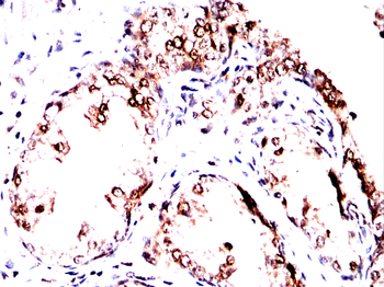 PRMT5 Antibody