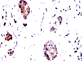 PRMT5 Antibody