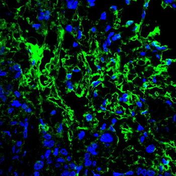 PRMT5 Antibody