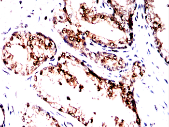 PRMT5 Antibody