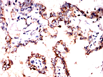 PRDX3 Antibody
