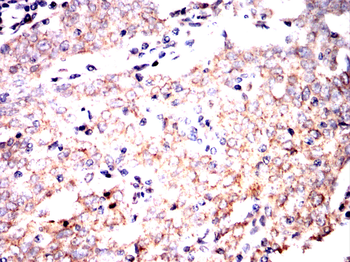 PRDX3 Antibody