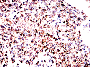 TFAM Antibody