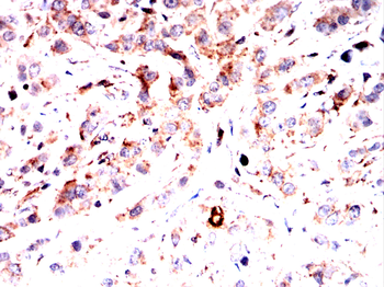 HDAC4 Antibody