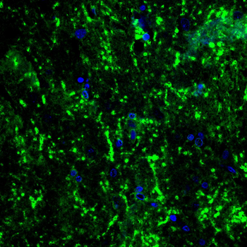 PLP1 Antibody