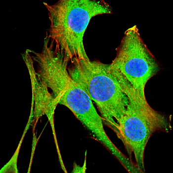 CLPP Antibody