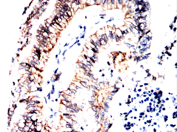 CLPP Antibody