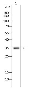 CLPP Antibody