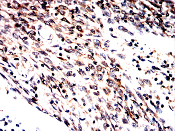 SLC12A1 Antibody