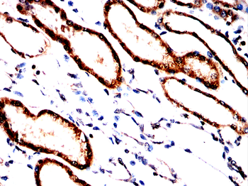 SLC12A1 Antibody