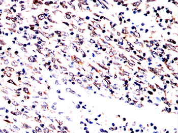 SLC12A1 Antibody