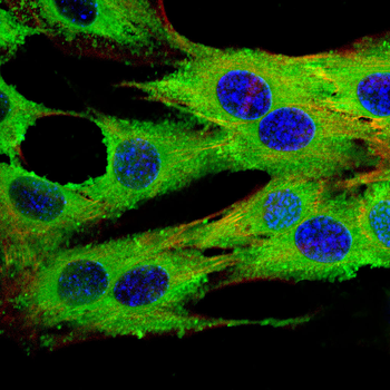 ADRB2 Antibody