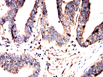 ADRB2 Antibody