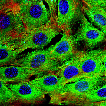 Lumican Rabbit Polyclonal Antibody