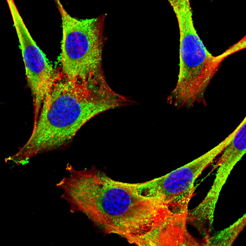 Lumican Rabbit Polyclonal Antibody