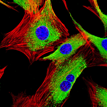 NOTCH1 Antibody