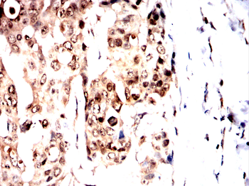 NOTCH1 Antibody