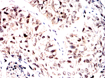 NOTCH1 Antibody