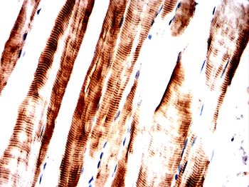 NOTCH1 Antibody