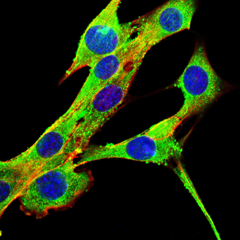 NOTCH1 Antibody