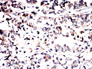 DCAF13 Antibody