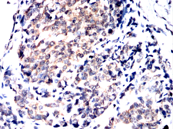 DCAF13 Antibody