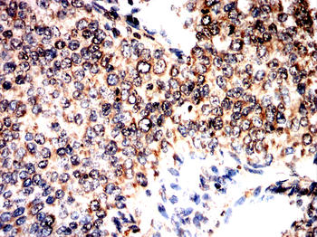 FTO Antibody