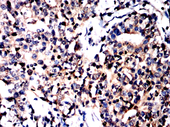 FTO Antibody