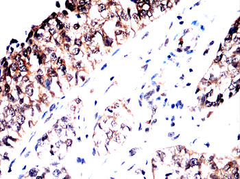 CPT1A Antibody