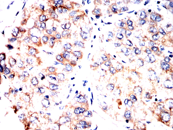 CPT1A Antibody