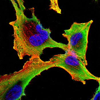 CPT1A Antibody