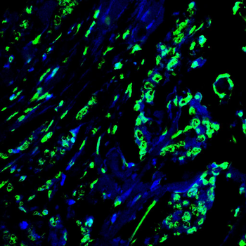 CHAT Antibody