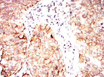 CHAT Antibody
