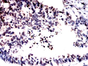 FOXM1 Antibody