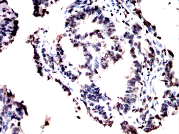 FOXM1 Antibody