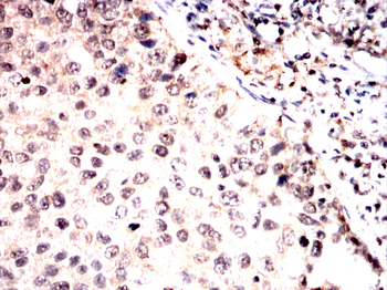 ROCK2 Antibody