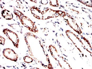 ACLY Antibody