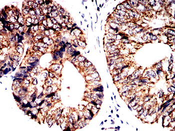 ACLY Antibody